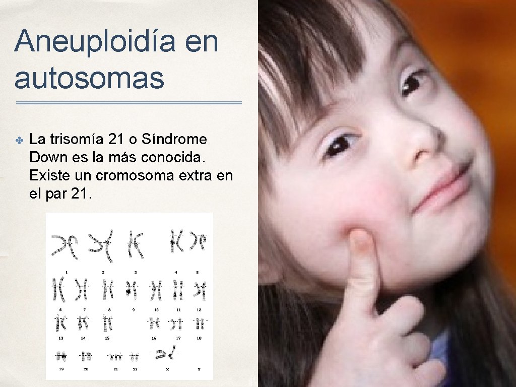 Aneuploidía en autosomas ✤ La trisomía 21 o Síndrome Down es la más conocida. Aneuploidía en autosomas ✤ La trisomía 21 o Síndrome Down es la más conocida.