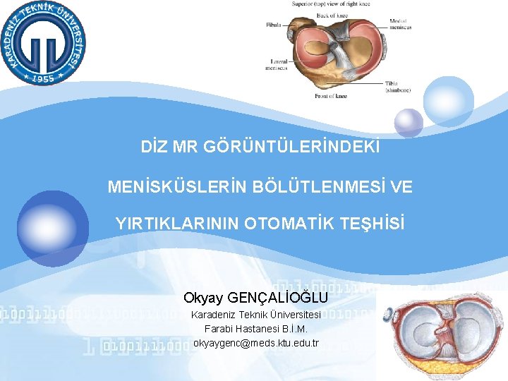 LOGO DİZ MR GÖRÜNTÜLERİNDEKİ MENİSKÜSLERİN BÖLÜTLENMESİ VE YIRTIKLARININ OTOMATİK TEŞHİSİ Okyay GENÇALİOĞLU Karadeniz Teknik