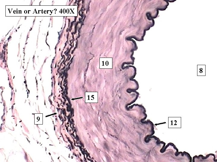 Vein or Artery? 400 X 10 8 15 9 12 