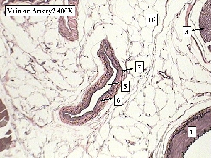 Vein or Artery? 400 X 16 3 7 5 6 1 