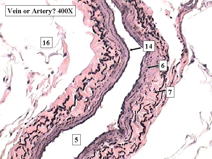 Vein or Artery? 400 X 16 14 6 7 5 