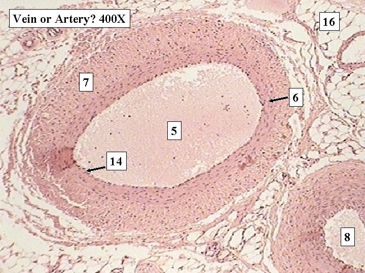 Vein or Artery? 400 X 16 7 6 5 14 8 