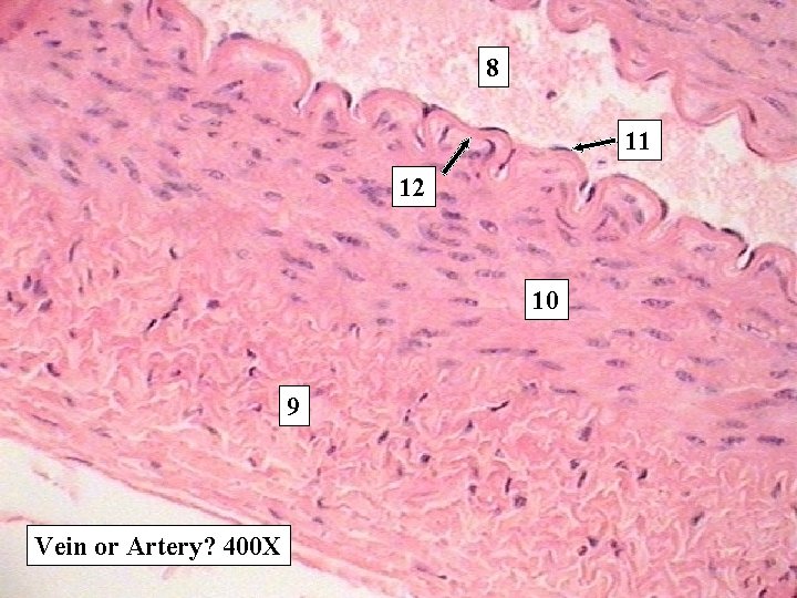 8 11 12 10 9 Vein or Artery? 400 X 