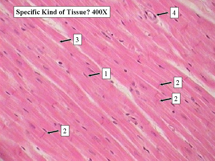 Specific Kind of Tissue? 400 X 4 3 1 2 2 2 