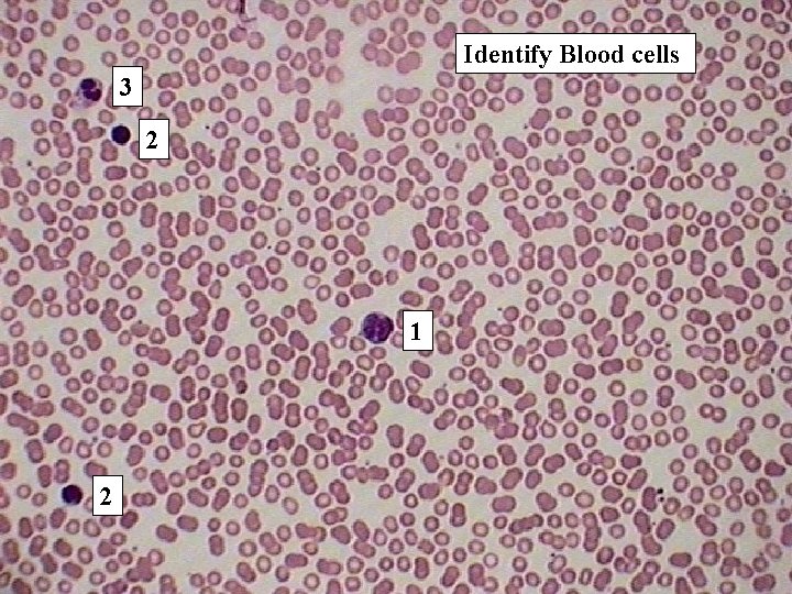 Identify Blood cells 3 2 1 2 