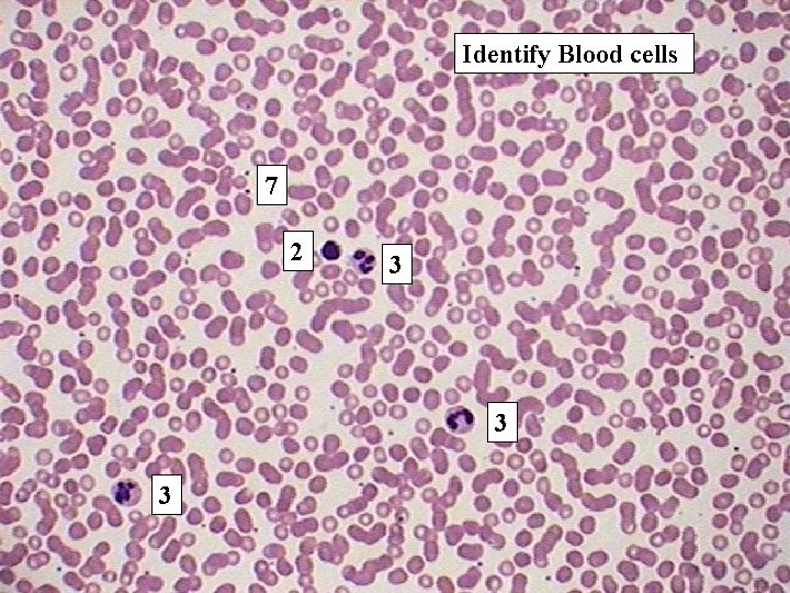 Identify Blood cells 7 2 3 3 3 