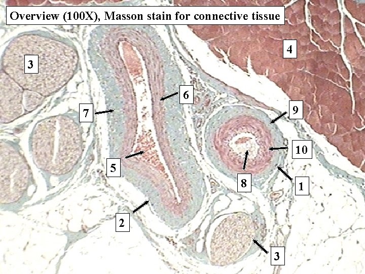 Overview (100 X), Masson stain for connective tissue 4 3 6 9 7 10