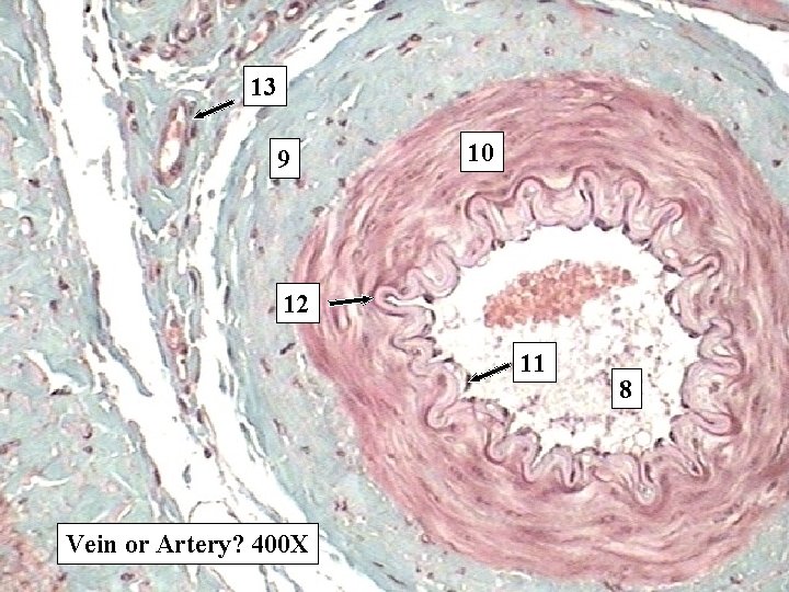 13 9 10 12 11 Vein or Artery? 400 X 8 