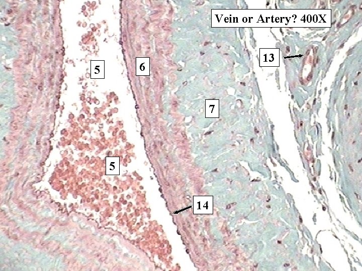 Vein or Artery? 400 X 13 6 5 7 5 14 