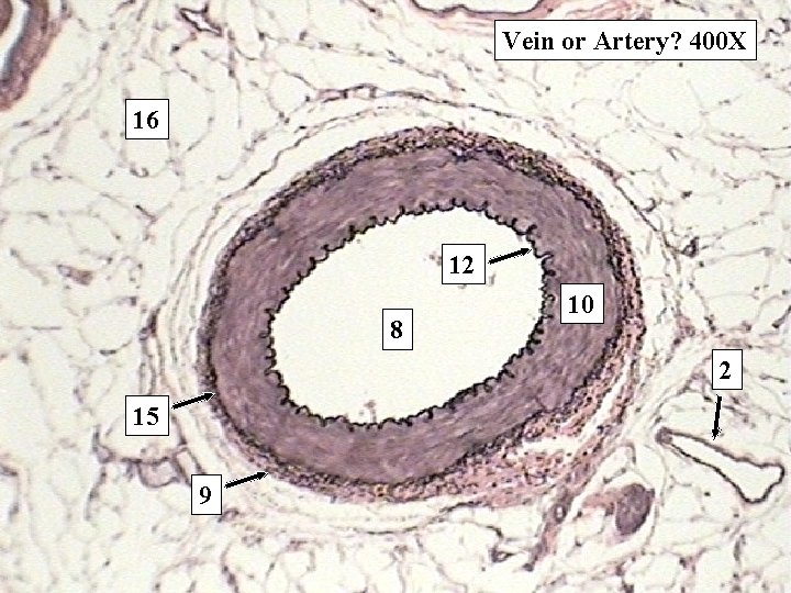Vein or Artery? 400 X 16 12 8 10 2 15 9 