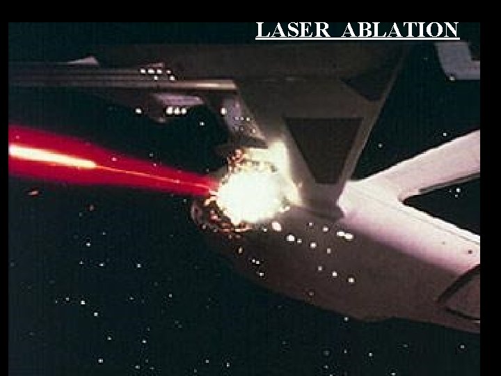 LASER ABLATION 1 