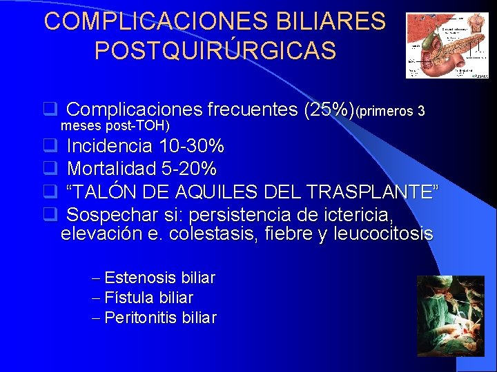 COMPLICACIONES BILIARES POSTQUIRÚRGICAS q Complicaciones frecuentes (25%)(primeros 3 meses post-TOH) q Incidencia 10 -30%
