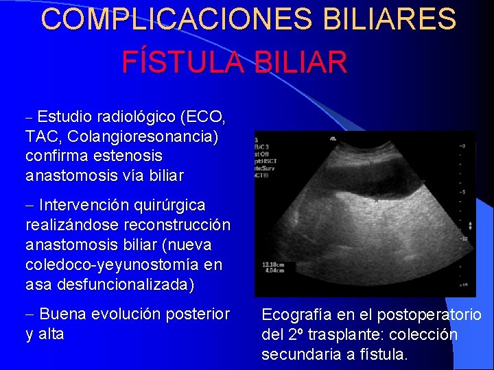 COMPLICACIONES BILIARES FÍSTULA BILIAR - Estudio radiológico (ECO, TAC, Colangioresonancia) confirma estenosis anastomosis vía