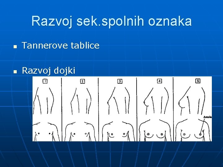 Razvoj sek. spolnih oznaka n Tannerove tablice n Razvoj dojki 