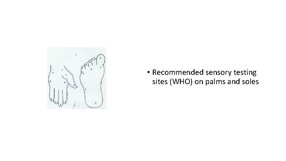  • Recommended sensory testing sites (WHO) on palms and soles 