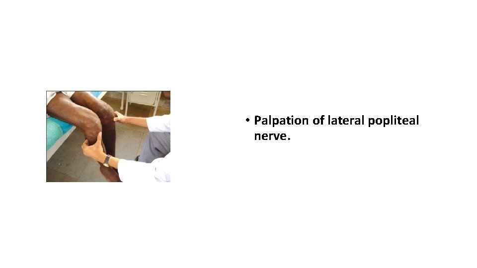  • Palpation of lateral popliteal nerve. 