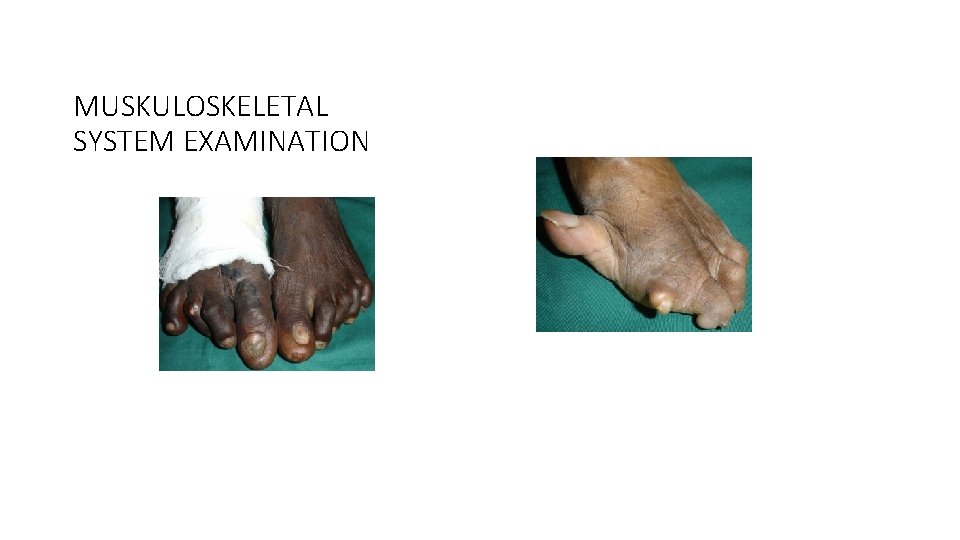 MUSKULOSKELETAL SYSTEM EXAMINATION 