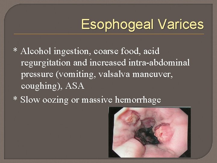 Esophogeal Varices * Alcohol ingestion, coarse food, acid regurgitation and increased intra-abdominal pressure (vomiting,