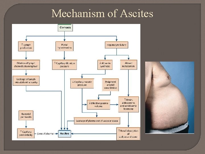 Mechanism of Ascites 