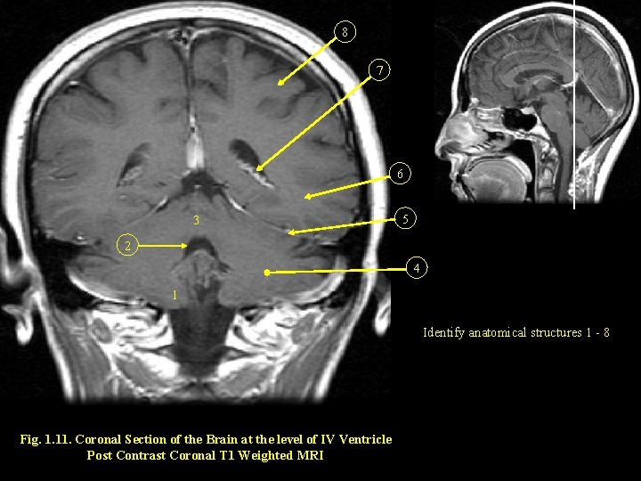 8 7 6 3 5 2 4 1 Identify anatomical structures 1 - 8