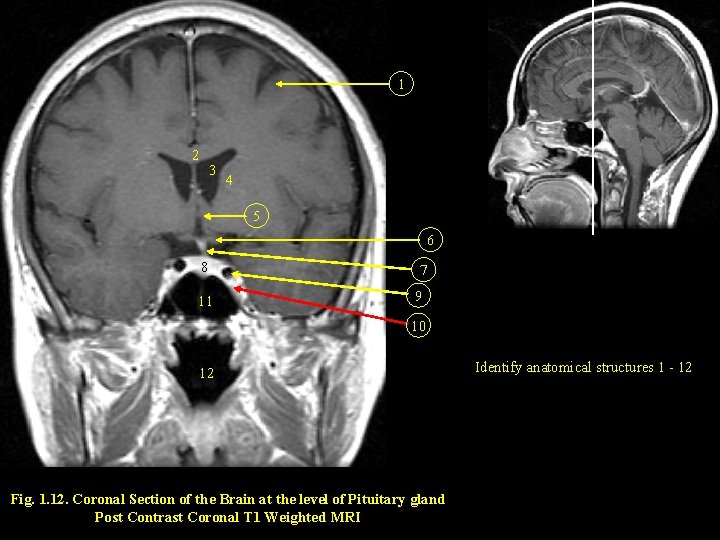 1 2 3 4 5 6 8 11 7 9 10 12 Fig. 1.