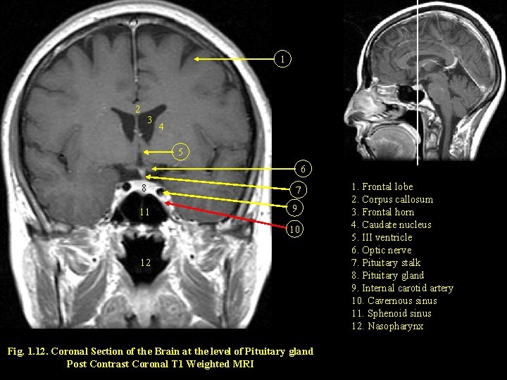 1 2 3 4 5 6 8 11 7 9 10 12 Fig. 1.