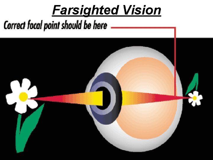 Farsighted Vision 25 