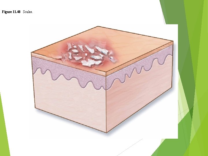 Figure 11. 48 Scales. 