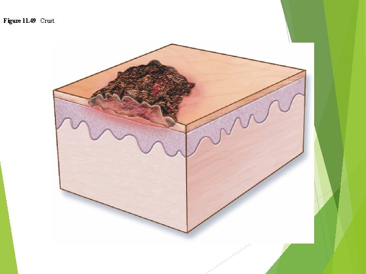 Figure 11. 49 Crust. 