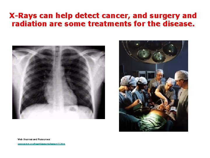 X-Rays can help detect cancer, and surgery and radiation are some treatments for the