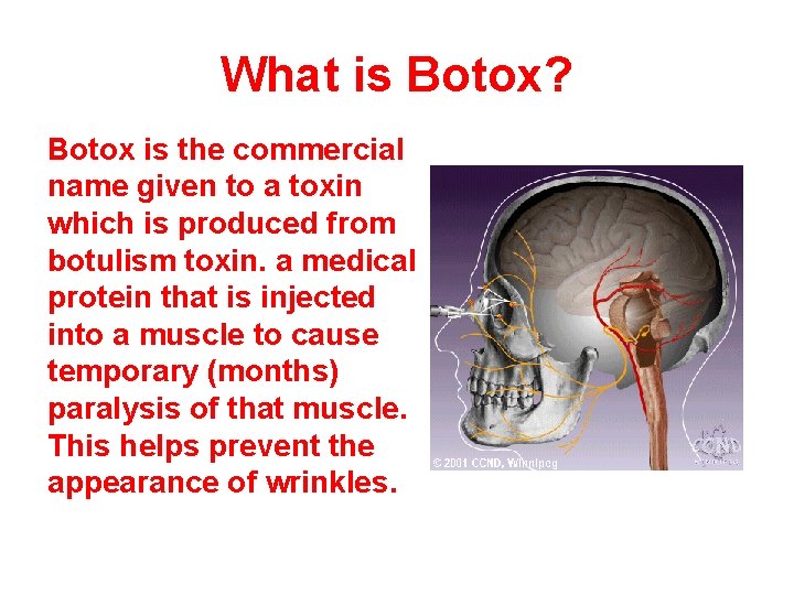 What is Botox? Botox is the commercial name given to a toxin which is