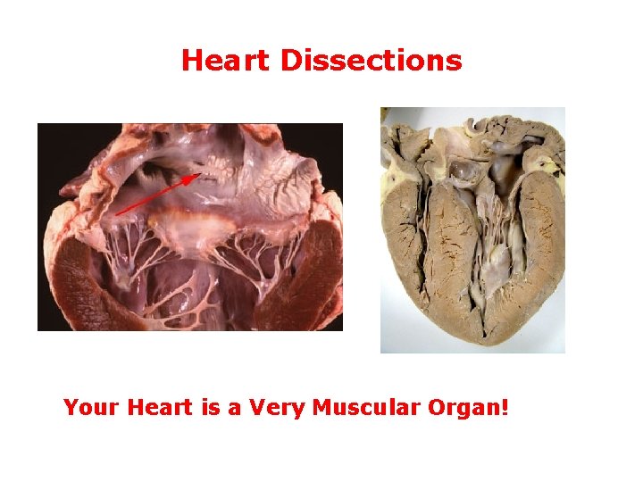 Heart Dissections Your Heart is a Very Muscular Organ! 