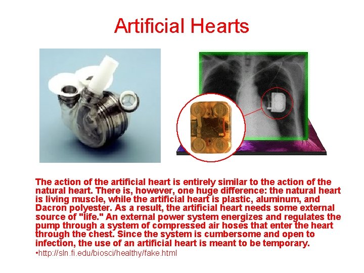 Artificial Hearts The action of the artificial heart is entirely similar to the action
