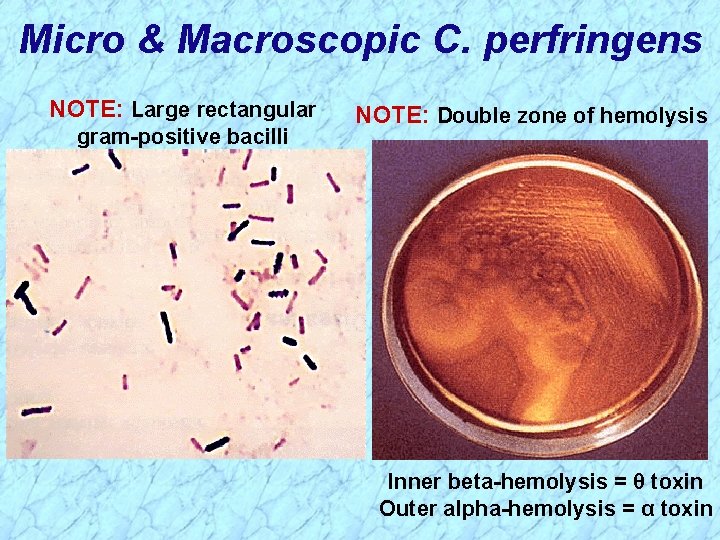 Micro & Macroscopic C. perfringens NOTE: Large rectangular gram-positive bacilli NOTE: Double zone of