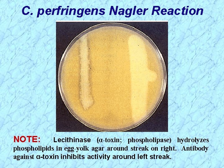 C. perfringens Nagler Reaction NOTE: Lecithinase (α-toxin; phospholipase) hydrolyzes phospholipids in egg-yolk agar around