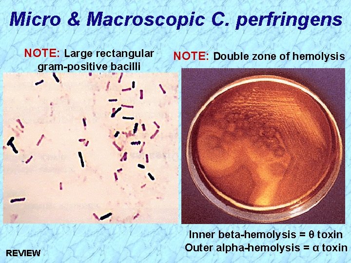 Micro & Macroscopic C. perfringens NOTE: Large rectangular gram-positive bacilli REVIEW NOTE: Double zone