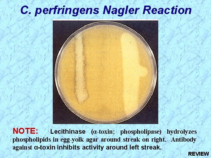 C. perfringens Nagler Reaction NOTE: Lecithinase (α-toxin; phospholipase) hydrolyzes phospholipids in egg-yolk agar around