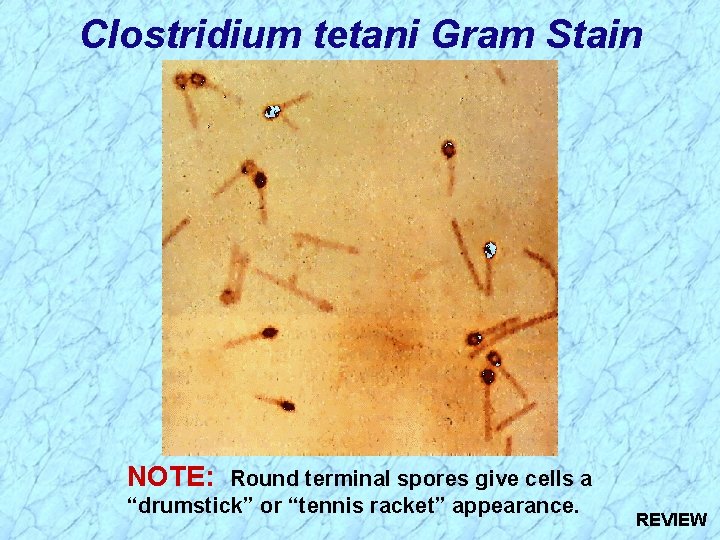 Clostridium tetani Gram Stain NOTE: Round terminal spores give cells a “drumstick” or “tennis