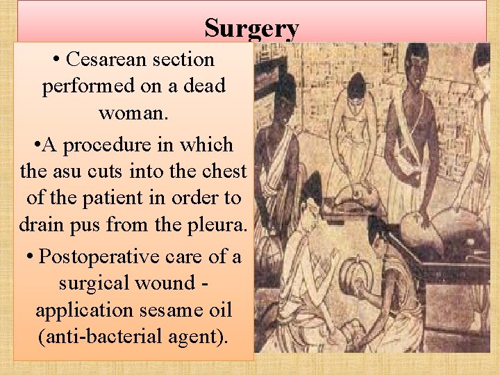 Surgery • Cesarean section performed on a dead woman. • A procedure in which