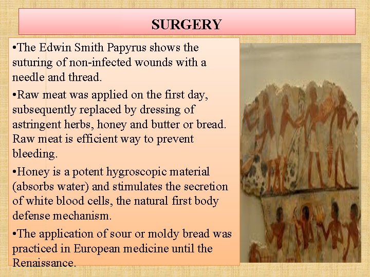 SURGERY • The Edwin Smith Papyrus shows the suturing of non-infected wounds with a