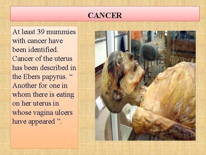 CANCER At least 39 mummies with cancer have been identified. Cancer of the uterus