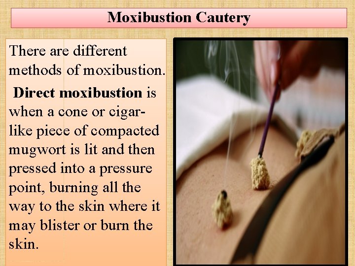 Moxibustion Cautery There are different methods of moxibustion. Direct moxibustion is when a cone