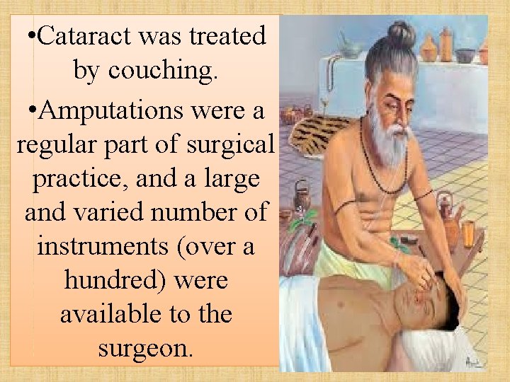  • Cataract was treated by couching. • Amputations were a regular part of