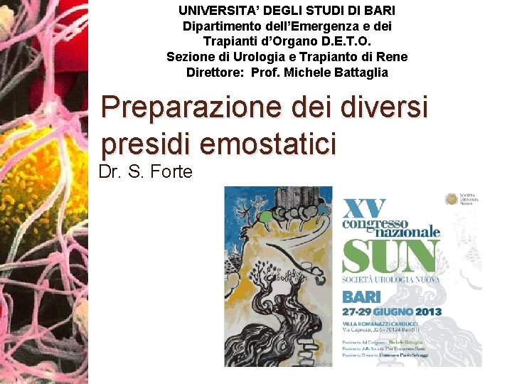 UNIVERSITA’ DEGLI STUDI DI BARI Dipartimento dell’Emergenza e dei Trapianti d’Organo D. E. T.