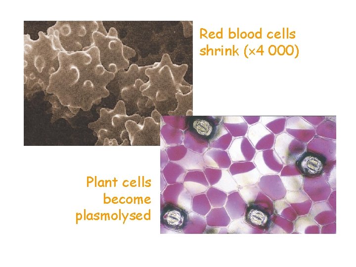 Red blood cells shrink ( 4 000) Plant cells become plasmolysed 