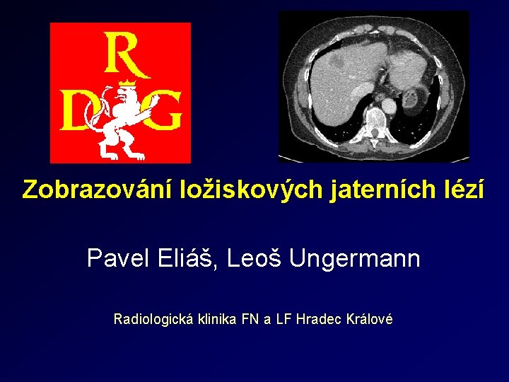 Zobrazování ložiskových jaterních lézí Pavel Eliáš, Leoš Ungermann Radiologická klinika FN a LF Hradec