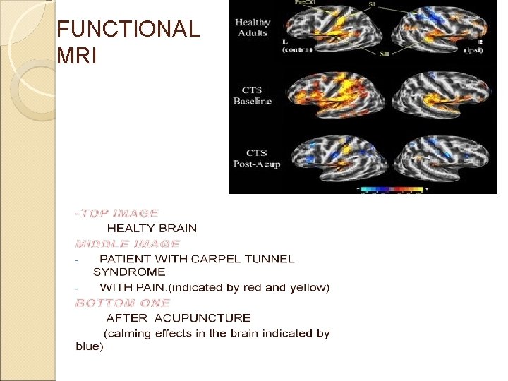 FUNCTIONAL MRI FUNCTIONAL MRI