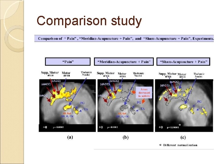 Comparison study Comparison study