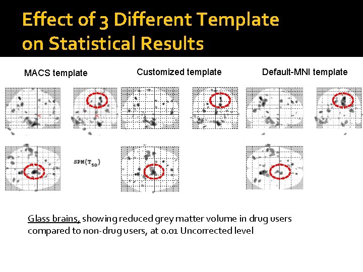 Effect of 3 Different Template on Statistical Results MACS template Customized template Default-MNI template