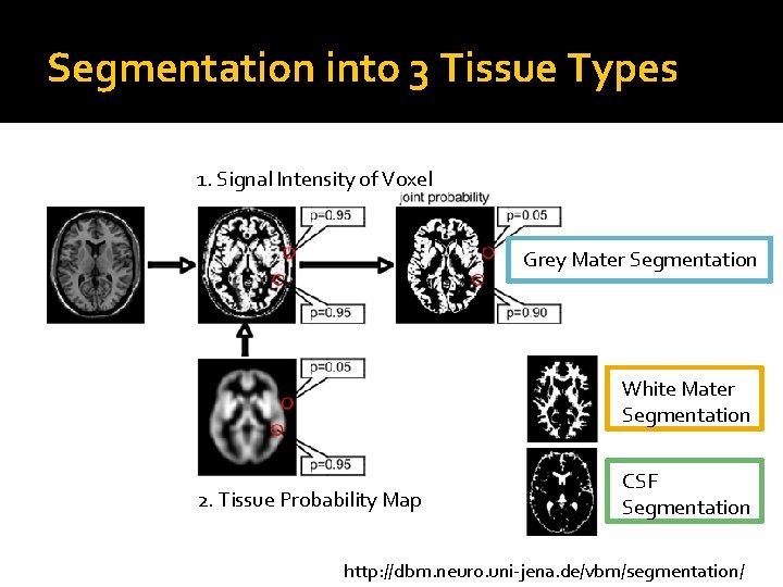 Segmentation into 3 Tissue Types 1. Signal Intensity of Voxel Grey Mater Segmentation White